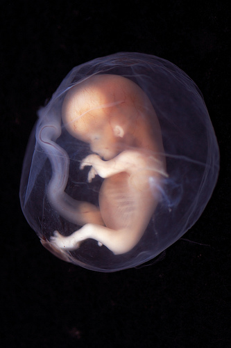 Fetus2, de Lunar Caustic